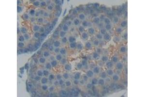 IHC-P analysis of Human Tissue, with DAB staining. (IL13 Receptor alpha 1 anticorps  (AA 137-210))