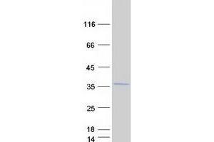 Validation with Western Blot