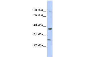 WB Suggested Anti-MYD88 Antibody Titration: 0. (MYD88 anticorps  (N-Term))