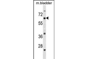 anti-Cat Eye Syndrome Chromosome Region, Candidate 6 (CECR6) (AA 504-531), (C-Term) antibody