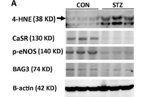 Mesenteric vascular Western blot graph (A) and analysis of 4-HNE (B), CaSR (C), p-eNOS (D) and BAG3 (E) are demonstrated.