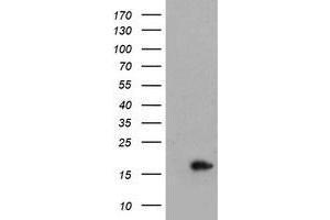 Image no. 1 for anti-Cellular Retinoic Acid Binding Protein 2 (CRABP2) antibody (ABIN1497621) (CRABP2 anticorps)