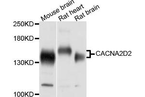 Western blot analysis of extracts of various cell lines, using CACNA2D2 antibody (ABIN5997344) at 1/1000 dilution. (CACNA2D2 anticorps)