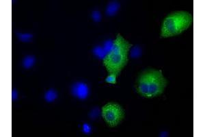 Image no. 2 for anti-Transforming, Acidic Coiled-Coil Containing Protein 3 (TACC3) antibody (ABIN1498096)