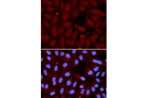 Immunofluorescence (IF) image for anti-Surfactant Protein C (SFTPC) antibody (ABIN1874760) (Surfactant Protein C anticorps)