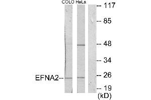 Western blot analysis of extracts from COLO205 cells and HeLa cells, using EFNA2 antibody.