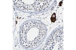 Immunohistochemical staining of human testis with LOC203547 polyclonal antibody  shows strong cytoplasmic positivity in Leydig cells. (VMA21 anticorps)
