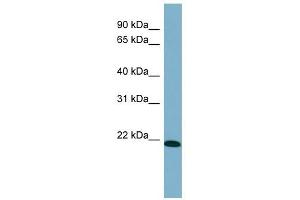 TIRAP antibody used at 1 ug/ml to detect target protein. (TIRAP anticorps)