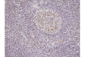 This image shows paraffin-embedded human palatine tonsil tissue sample stained with anti-NPM antibody (5E3) at 1:100 dilution.