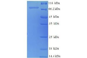 SDS-PAGE (SDS) image for Nuclear RNA Export Factor 3 (NXF3) (AA 1-531), (full length) protein (His-SUMO Tag) (ABIN5710037)