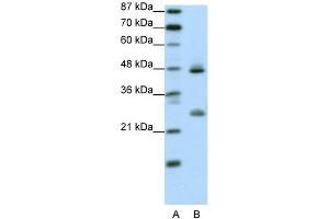 WB Suggested Anti-KLF6 Antibody Titration:  0. (KLF6 anticorps  (Middle Region))