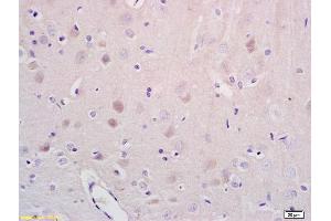 Formalin-fixed and paraffin embedded rat brain tissue labeled with Anti-NR1D1/REV-ERB alpha Polyclonal Antibody, Unconjugated (ABIN700854) at 1:200 followed by conjugation to the secondary antibody and DAB staining