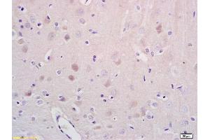 Formalin-fixed and paraffin embedded rat brain tissue labeled with Anti-NR1D1/REV-ERB alpha Polyclonal Antibody, Unconjugated (ABIN700854) at 1:200 followed by conjugation to the secondary antibody and DAB staining (NR1D1 anticorps)