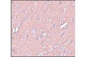 Immunohistochemistry of SYNGR3 in rat brain tissue with this product at 2. (Synaptogyrin 3 anticorps  (C-Term))