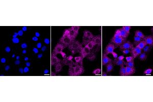 Immunocytochemical staining of HT- cells with GART antibody (ABIN7799834), 1:1,000). (Recombinant GART anticorps)