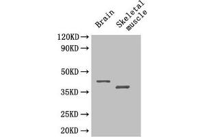 Western Blot Positive WB detected in: Mouse brain tissue, Mouse skeletal muscle tissue All lanes: SEPP1 antibody at 4 μg/mL Secondary Goat polyclonal to rabbit IgG at 1/50000 dilution Predicted band size: 43 kDa Observed band size: 43, 40 kDa (Selenoprotein P (SELENOP) (AA 20-381) anticorps)