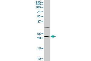 LATS1 monoclonal antibody (M09), clone 3A7.