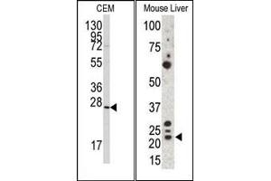 Image no. 1 for anti-Gremlin 1 (GREM1) (C-Term) antibody (ABIN358612)