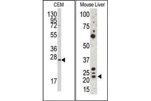 Image no. 1 for anti-Gremlin 1 (GREM1) (C-Term) antibody (ABIN358612) (GREM1 anticorps  (C-Term))