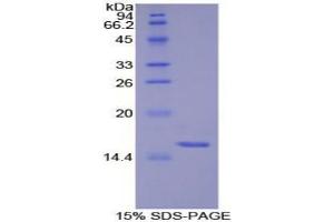 SDS-PAGE analysis of Human S100 Protein.
