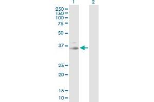 Western Blot analysis of PRKG1 expression in transfected 293T cell line by PRKG1 MaxPab polyclonal antibody. (PRKG1 anticorps  (AA 1-312))