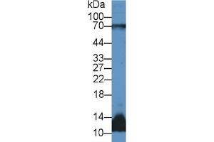 Rabbit Capture antibody from the kit in WB with Positive Control: Sample Human lung lysate.