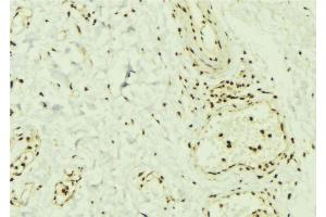 ABIN6269369 at 1/100 staining Mouse muscle tissue by IHC-P. (SMAD1 anticorps)