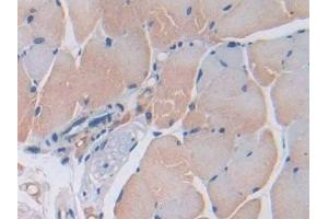 Detection of CD74 in Mouse Skeletal muscle Tissue using Polyclonal Antibody to Cluster Of Differentiation 74 (CD74)