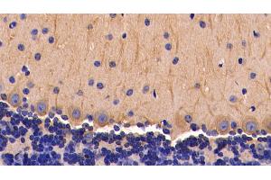 Detection of TNFa in Mouse Cerebellum Tissue using Polyclonal Antibody to Tumor Necrosis Factor Alpha (TNFa)