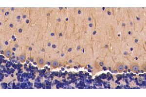 Detection of TNFa in Mouse Cerebellum Tissue using Polyclonal Antibody to Tumor Necrosis Factor Alpha (TNFa) (TNF alpha anticorps  (AA 80-235))