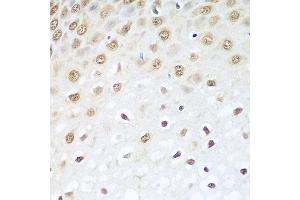Immunohistochemistry of paraffin-embedded human esophagus using BCAS2 antibody at dilution of 1:100 (40x lens). (BCAS2 anticorps)