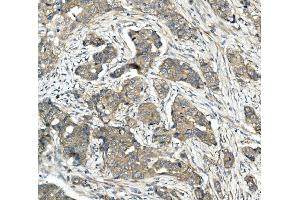 IHC analysis of CDR2 using anti-CDR2 antibody (ABIN7599397). (CDR2 anticorps  (AA 1-441))