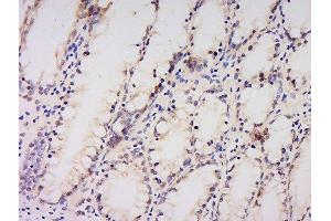 Formalin-fixed and paraffin embedded human kidney labeled with Anti-AMPK alpha-1 Polyclonal Antibody, Unconjugated  at 1:200 followed by conjugation to the secondary antibody and DAB staining. (PRKAA1 anticorps  (AA 351-450))