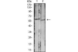 Western blot analysis using CD39 mouse mAb against HCT116 (1) and LOVO (2) cell lysate. (CD39 anticorps  (AA 38-179))