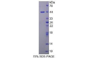 SDS-PAGE (SDS) image for Cerebral Dopamine Neurotrophic Factor (CDNF) (AA 33-187) protein (His tag,GST tag) (ABIN1878199) (CDNF Protein (AA 33-187) (His tag,GST tag))