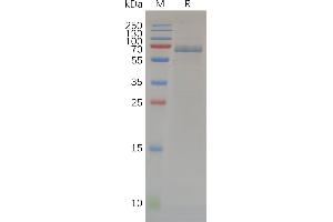 Human Protein, hFc Tag on SDS-PAGE under reducing condition.