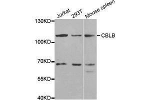 Western blot analysis of extracts of various cell lines, using CBLB antibody. (Cbl Proto-Oncogene B, E3 Ubiquitin Protein Ligase (CBLB) anticorps)