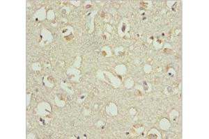 Immunohistochemistry of paraffin-embedded human brain tissue using ABIN7151541 at dilution of 1:100 (EEF1B2 anticorps  (AA 1-225))