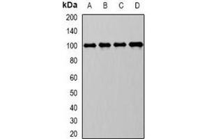 Western blot analysis of CD10 expression in Raji (A), MCF7 (B), mouse kidney (C), mouse liver (D) whole cell lysates. (MME anticorps)