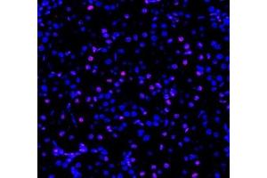 Immunofluorescent analysis of paraformaldehyde-fixed rat kidney using ADRA1B (ABIN7072974) at dilution of 1: 1200 (ADRA1B anticorps)