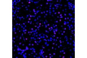 Immunofluorescent analysis of paraformaldehyde-fixed rat kidney using ADRA1B (ABIN7072974) at dilution of 1: 1200 (ADRA1B anticorps)