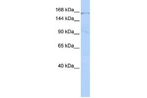 WB Suggested Anti-ZNF236 Antibody Titration:  0. (ZNF236 anticorps  (Middle Region))