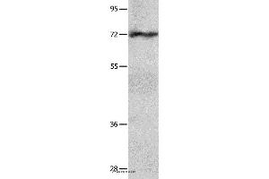 Western blot analysis of Hela cell  , using IGF2BP1 Polyclonal Antibody at dilution of 1:750 (IGF2BP1 anticorps)