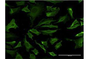 Immunofluorescence of monoclonal antibody to AKT1 on HeLa cell.
