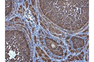 IHC-P Image ATG4D antibody [N3C3] detects ATG4D protein at cytoplasm in mouse ovary by immunohistochemical analysis. (ATG4D anticorps  (Center))