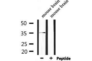 Western blot analysis of extracts from mouse brain, using Olfactory receptor 5AP2 Antibody. (OR5AP2 anticorps)