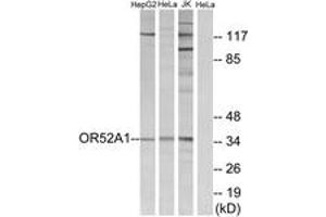 Western Blotting (WB) image for anti-Olfactory Receptor, Family 52, Subfamily A, Member 1 (OR52A1) (AA 20-69) antibody (ABIN2891124) (OR52A1 anticorps  (AA 20-69))