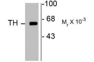 Image no. 1 for anti-Tyrosine Hydroxylase (TH) antibody (ABIN372734)
