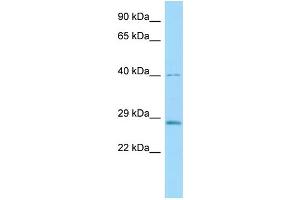 Host: Rabbit Target Name: Cela3b Sample Type: Rat Pancreas lysates Antibody Dilution: 1.