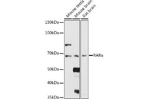 Western blot analysis of extracts of various cell lines, using RARα antibody (ABIN6128615, ABIN6146692, ABIN6146695 and ABIN6213825) at 1:1000 dilution.